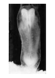 Stage 10 - dorsal view of Carnegie specimen #6330