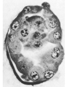 Stage 3 - Section through a 58 cell blastocyst (Carnegie specimen #8794)