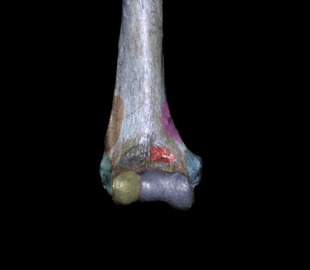 highlighted distal humerus