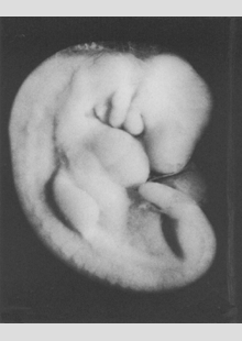 Virtual Human Embryo Carnegie Stage 13