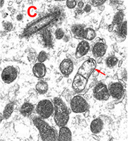 Fig. 10. Detail of sperm mitochondria