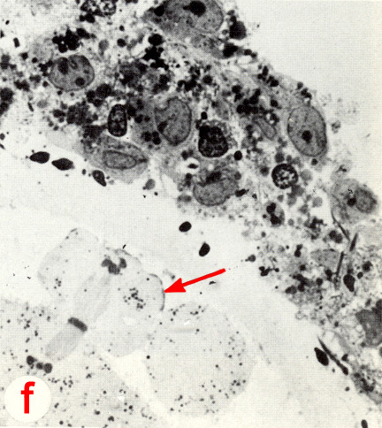 Stage 1a Figure 3f : telophase II of the second polar body, 3 hours post-insemination