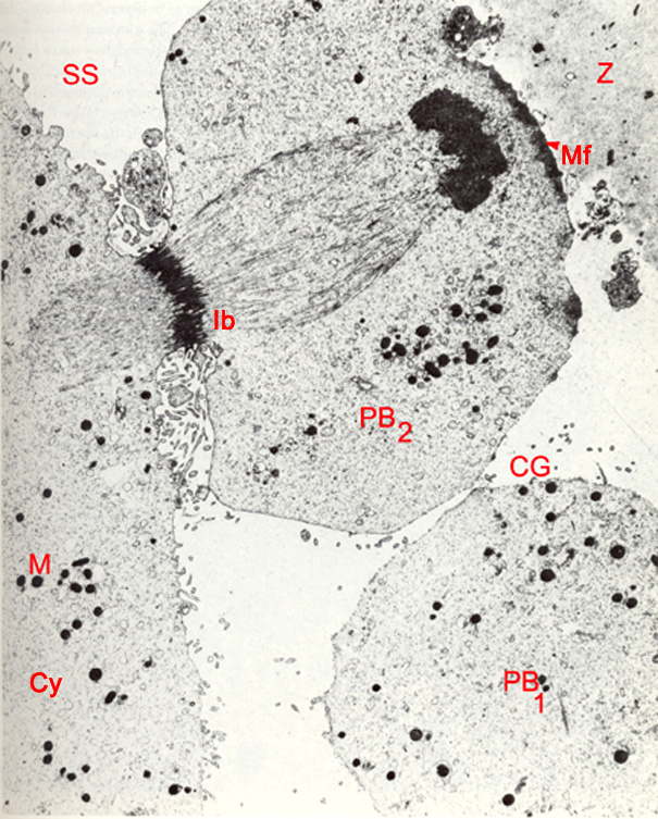 Stage 1a Figure 9: 