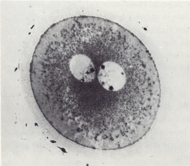 Stage 1b Figure 2 : stage 1b embryo in vitro with a narrow interpronuclear zone 