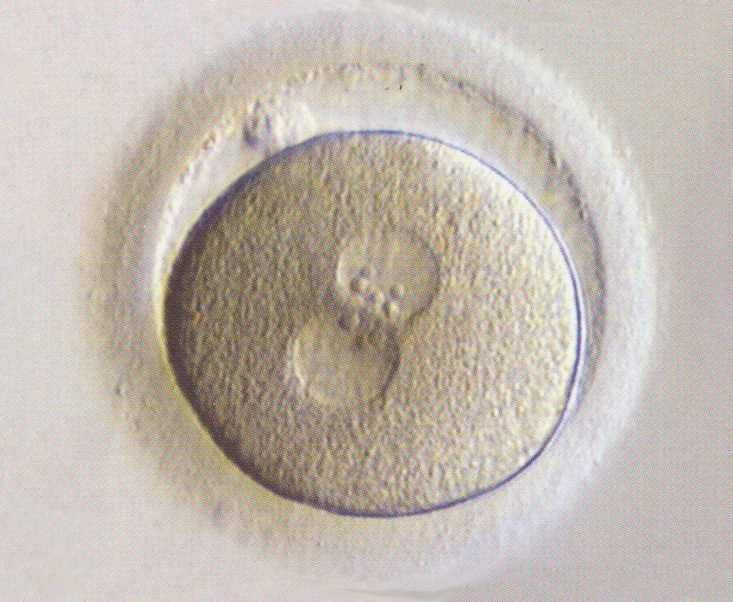Stage 1b Figure 3: stage 1b embryo in vitro with two pronuclei 