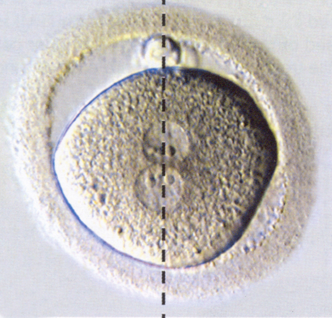 Stage 1b Figure 4: a polarized stage 1b embryo 