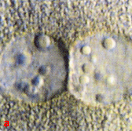 6a: LM close-ups of pronuclei