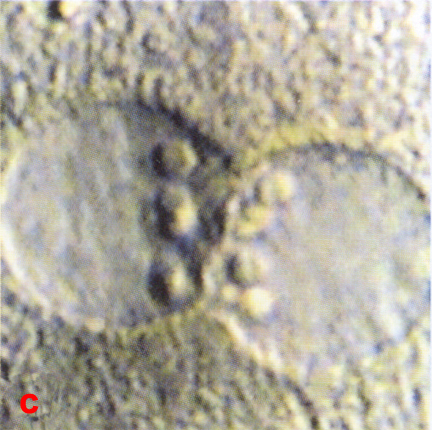 6c: LM close-ups of pronuclei