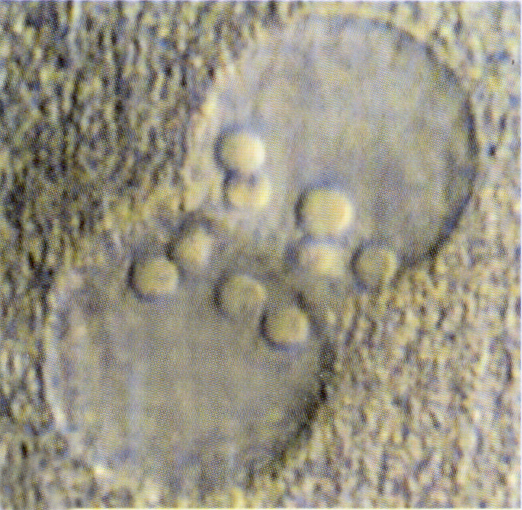 Stage 1b Figure 7: close up view of pronuclei in a stage 1b embryo 