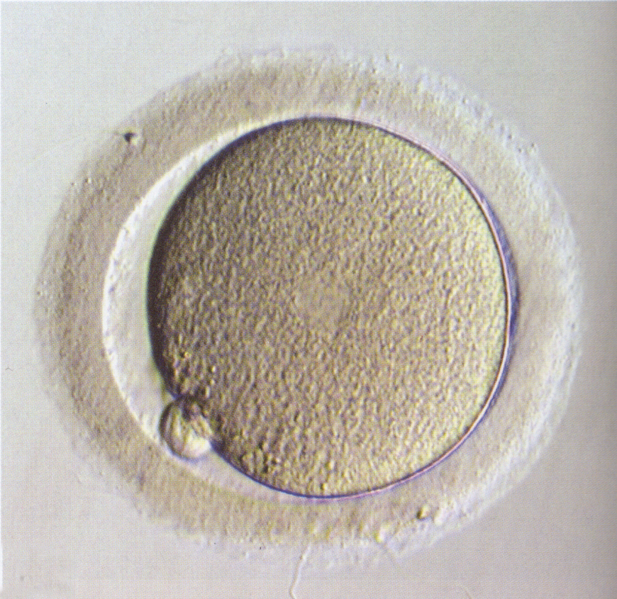 Stages 1c Figure 1: LM of a stage 1c embryo (zygote)