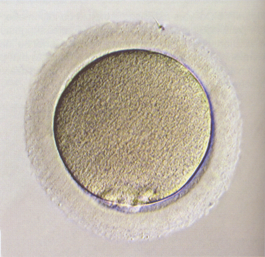 Stages 1c Figure 2: LM of a stage 1c embryo (zygote) in syngamy