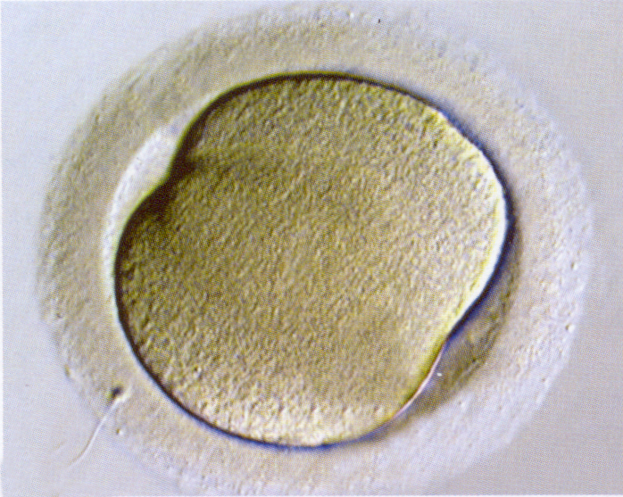 Stages 1c Figure 3: LM of a stage 1c embryo (zygote) at the beginning of the first cleavage