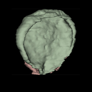 Image of embryo for section level reference