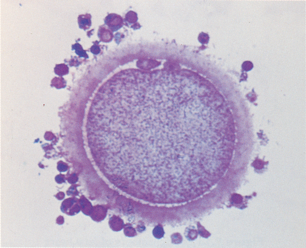 Stage 1a Figure 2 : Penetrated Oocyte in vitro